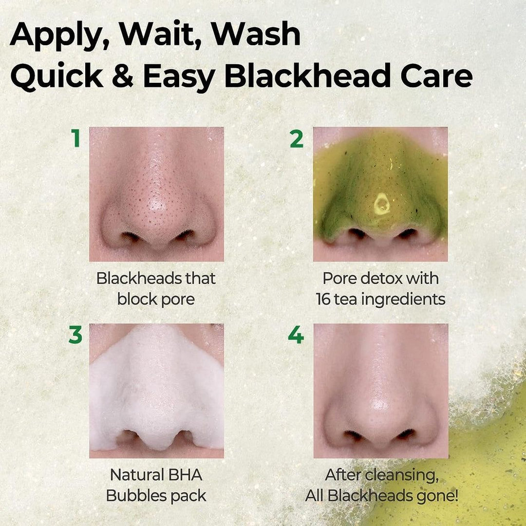 Some by Mi Bye Bye BlackHead