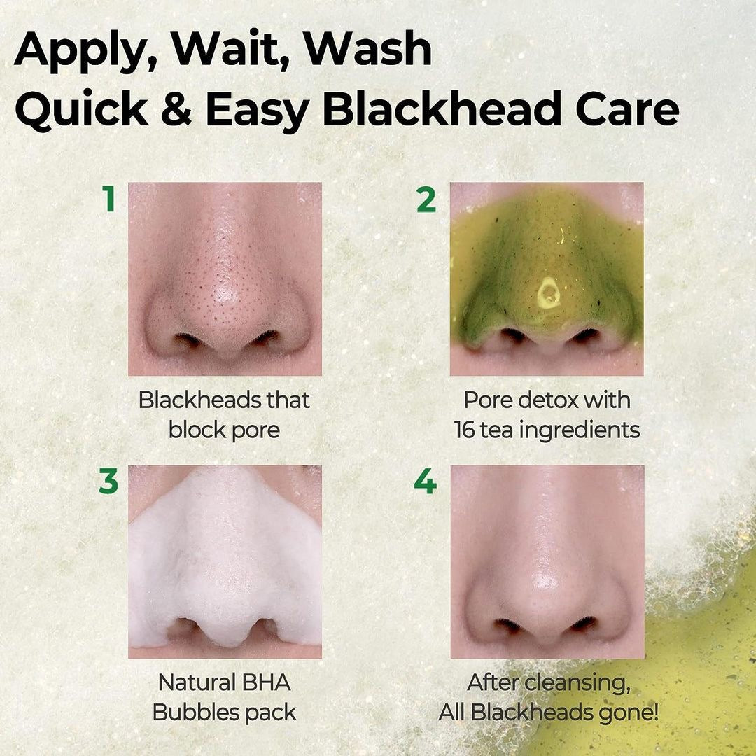 Some by Mi Bye Bye BlackHead